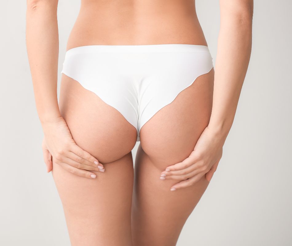 Levantamiento de Glúteos Sin Cirugía