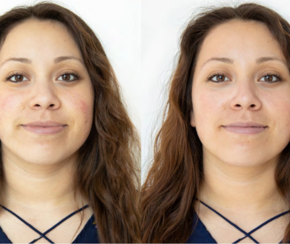 Resultados de maquina Hyfradacial