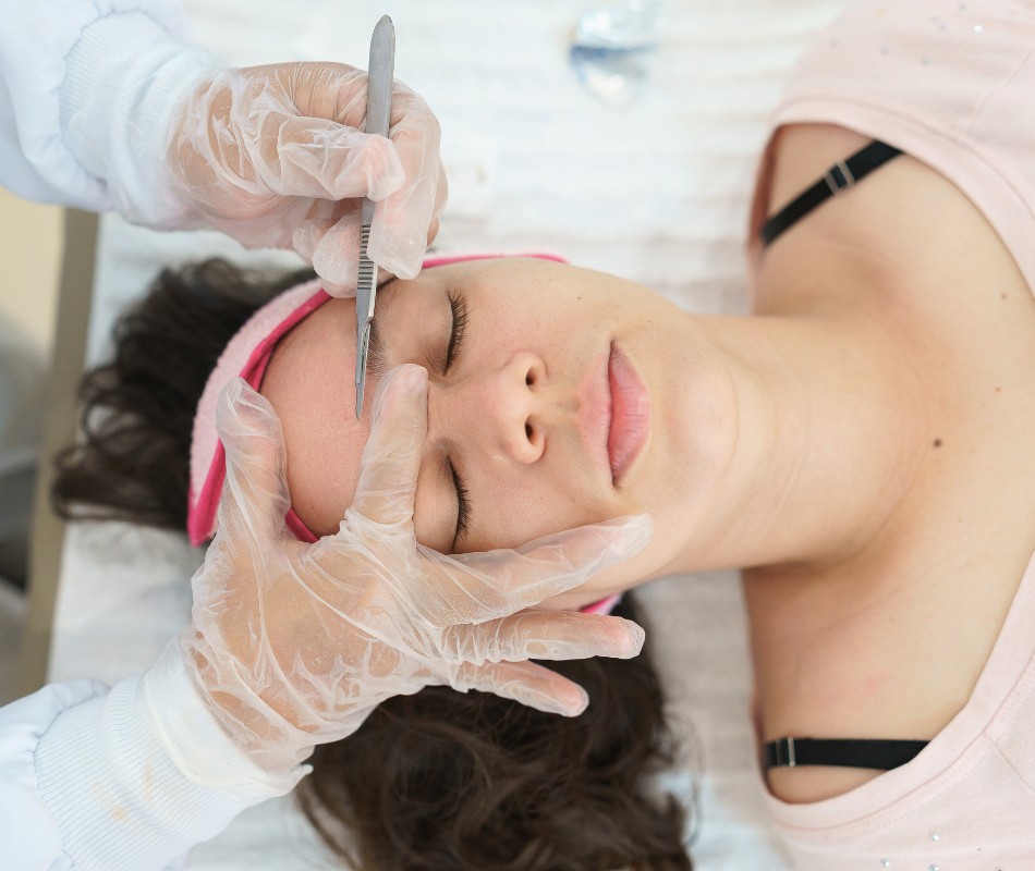Tratamiento facial Dermapen (5)