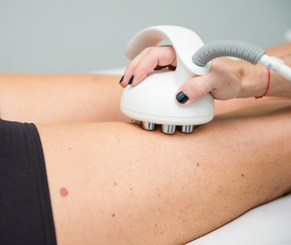 Tratamientos corporales con Venus Legacy