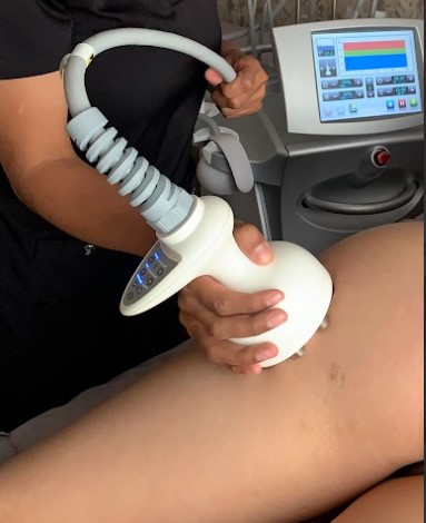 Eliminar Celulitis en Bogotá